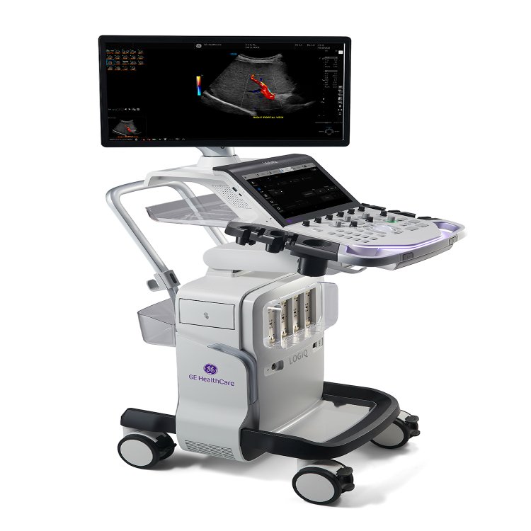 EQUIPAMENTO DE ULTRASSOM LOGIQ TOTUS